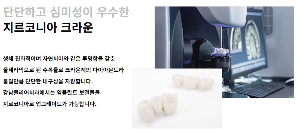 강남임플란트잘하는치과 선택 시 중요한 것은? 관련 이미지 8