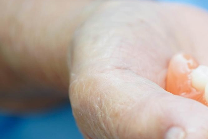 신경치료 후 통증이 생기는 이유 관련 이미지 27