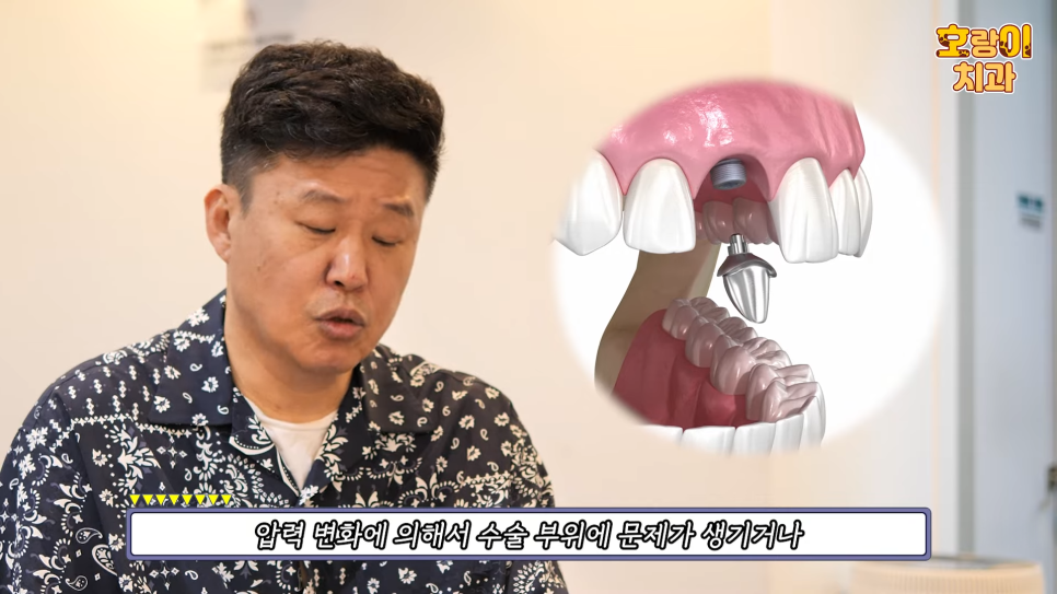 홍록기님과 함께하는 임플란트 Q&A 2편 관련 이미지 15