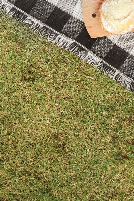 강남역 치과 임플란트 구조와 치료기간 관련 이미지 32