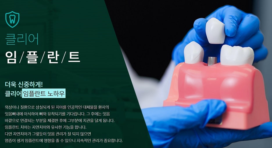강남 오스템임플란트 무엇인지 궁금하다면? 관련 이미지 2