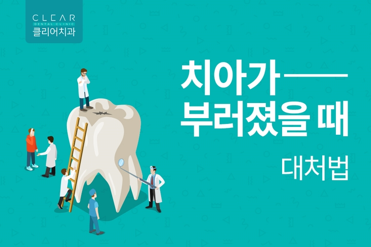 클리어치과와 알아보는 치아가 부러졌을 때 대처법 관련 이미지 2