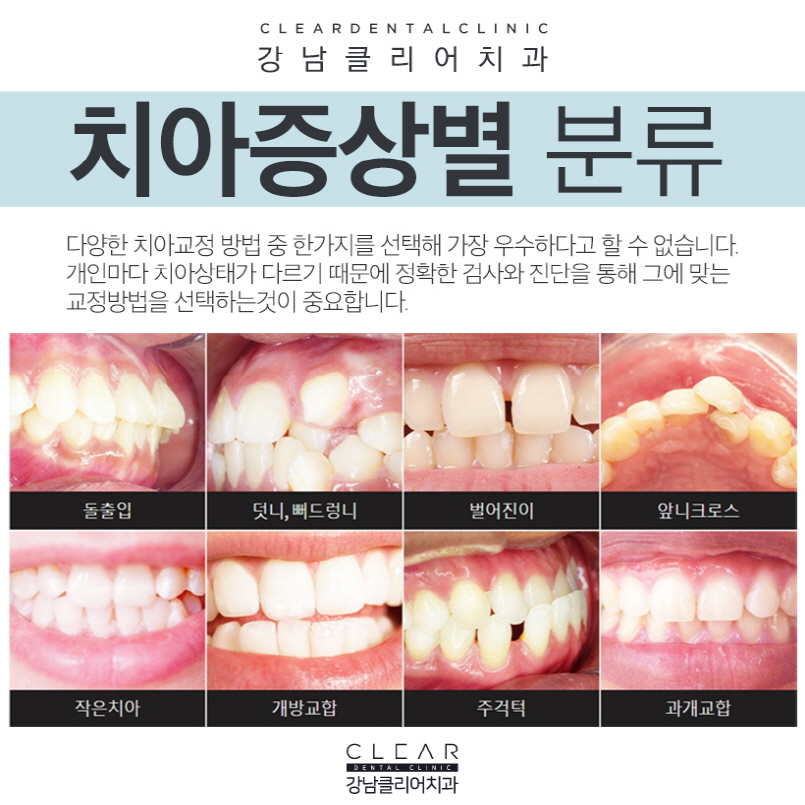 클리피씨교정비용 가격 이벤트로 혜택받기 관련 이미지 4