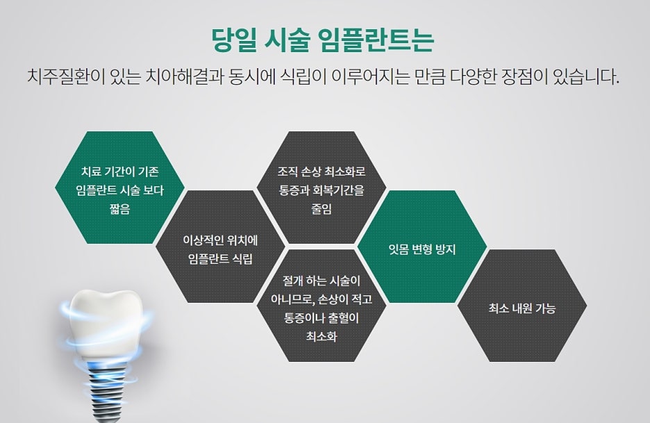 강남 원데이 임플란트 찾아보고 있을 경우 관련 이미지 7