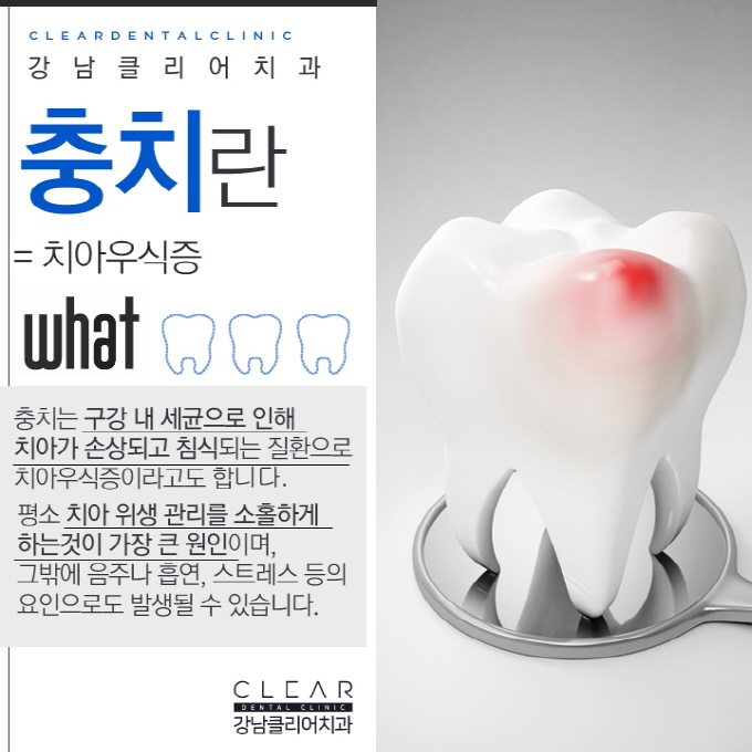 강남역스케일링 건강한 치아와 잇몸건강을 위해 관련 이미지 4