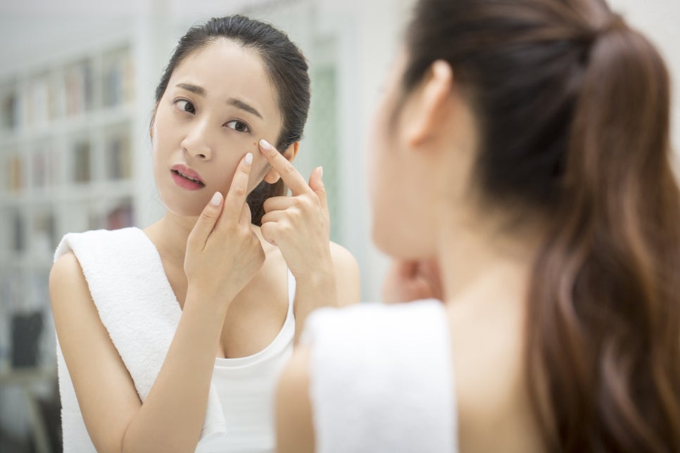 모낭염 증상 및 원인 여드름일까? 관련 이미지 2