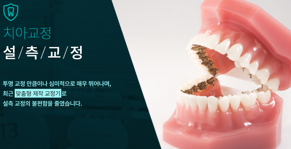 논현동교정치과 나에게 맞는 다양한 방법으로 관련 이미지 2
