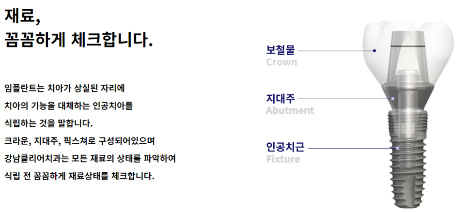 오스템 소이임플란트 합리적 선택해야 할 땐 관련 이미지 3