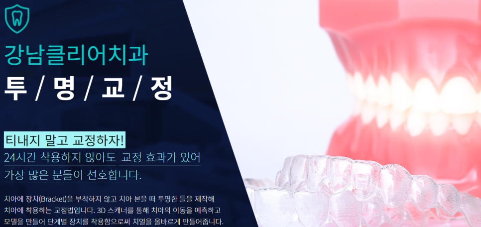 강남역치아교정치과 내 치아에 맞는 방법은? 관련 이미지 2