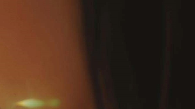 치아 스케일링 주기 치석관리를 위해서 관련 이미지 27