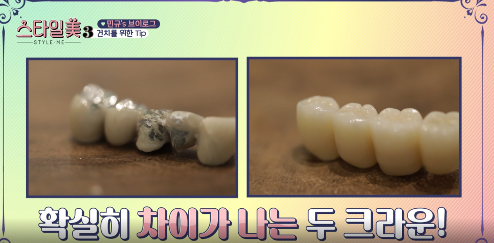 건치 치아 꿀팁 정기 검진으로 충지 예방해 보세요 관련 이미지 5