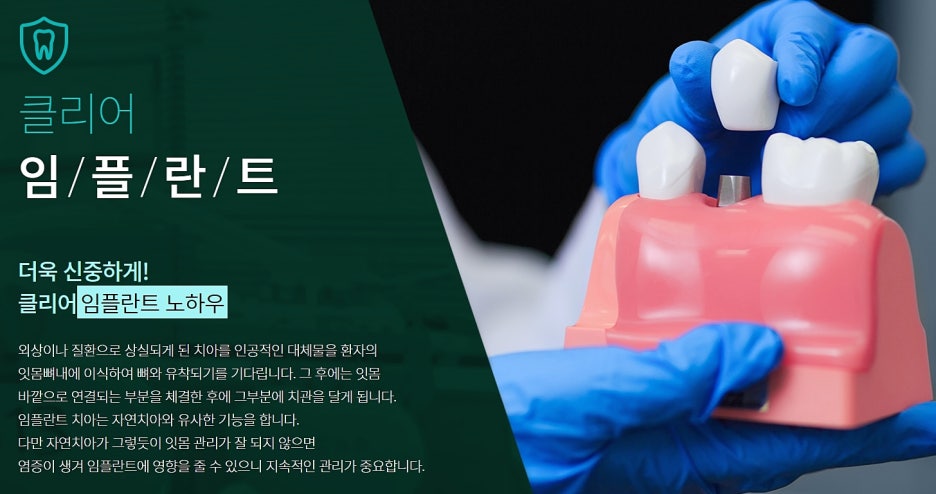 임플란트 환자중심 남다르고 싶어 관련 이미지 3
