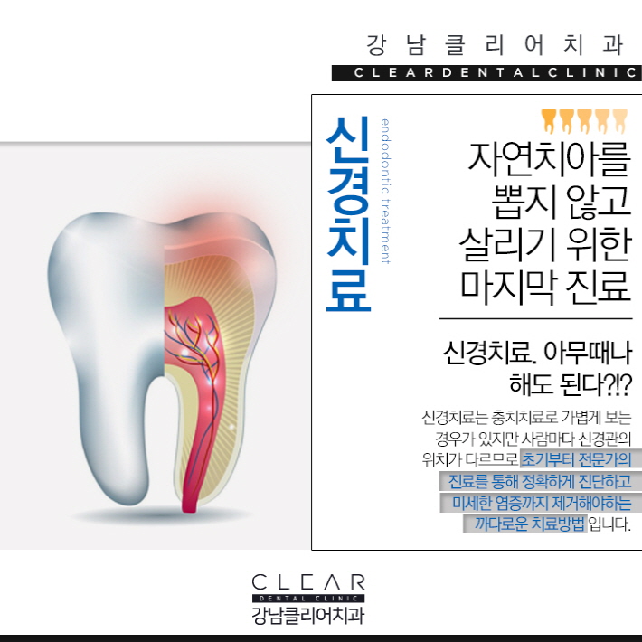 치아 신경치료 가볍고 쉽게 생각해선 안된다 관련 이미지 3