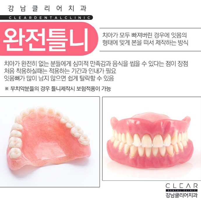 치아 보철치료 종류 심미보철 등 다양해 관련 이미지 10