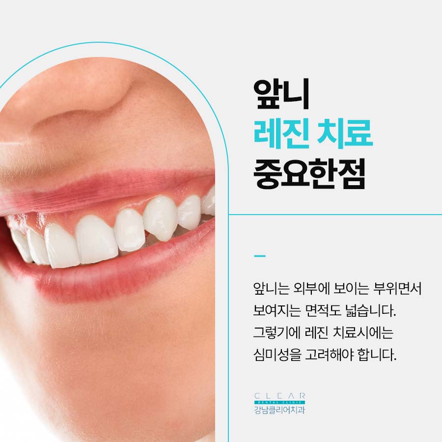 앞니 충치 레진 치료 자연스러워야 하니까 관련 이미지 3