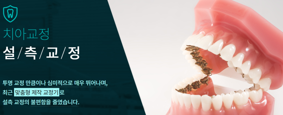 강남역치아교정치과 내 치아에 맞는 방법은? 관련 이미지 6