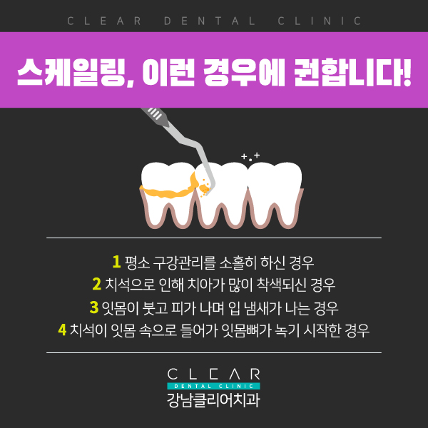 치아 스케일링 ,치석관리, 의료보험 혜택 관련 이미지 2