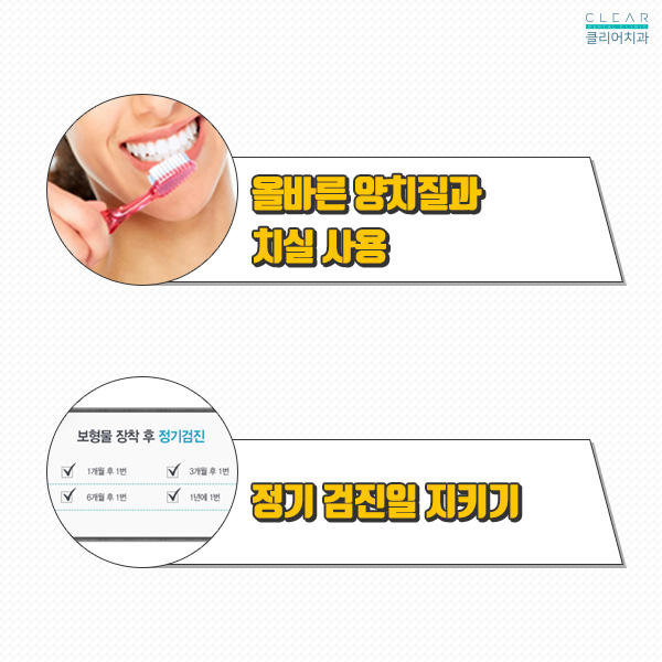 강남클리어치과에서 알려주는 임플란트 주의사항! 관련 이미지 4