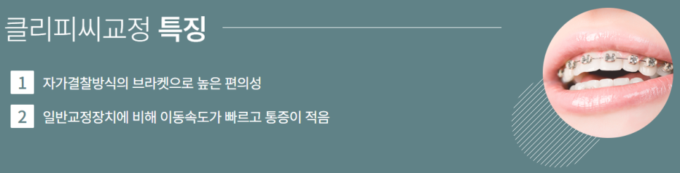 강남클리피씨교정 단 기간에 티나지 않게 관련 이미지 5