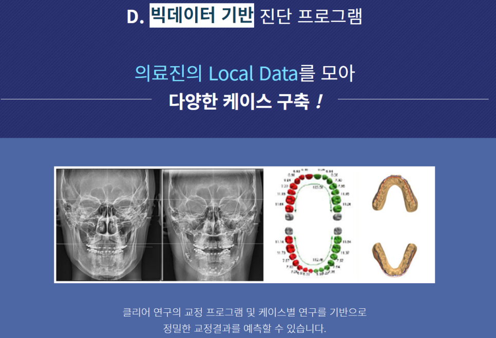 강남치아교정잘하는치과 가지런한 치아가 부럽다면 관련 이미지 7