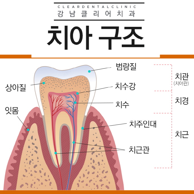 치과신경치료, 신경치료 후 크라운 꼭 해야하는걸까? 관련 이미지 2