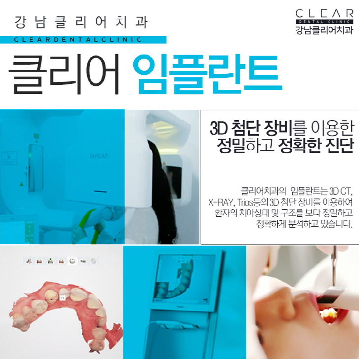 국산임플란트 가격 안정성 모두 경쟁력있어 관련 이미지 4