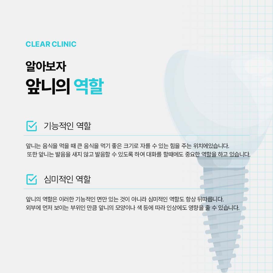 앞니발치 임플란트 난이도가 높은 이유 관련 이미지 3
