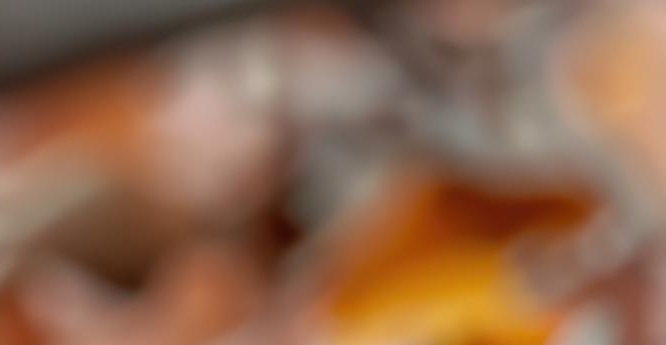 임플란트 정품 확인하고 내게 맞는 식립방법으로 관련 이미지 17