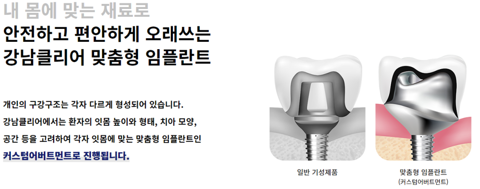 도곡동임플란트치과 영구치 손상이 있다면? 관련 이미지 6