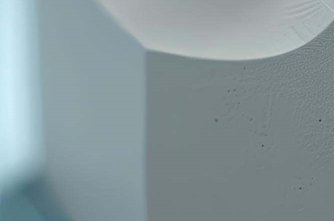 임플란트 구조 수명은 어느정도? 관련 이미지 21