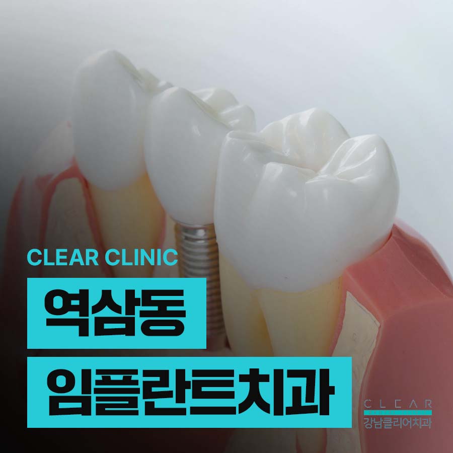 역삼동 임플란트 치과 유지기간 오래 쓰려면 주의사항 관련 이미지 1