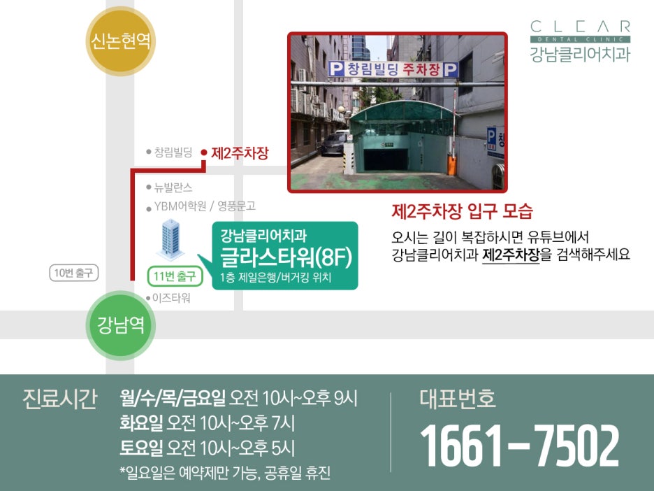 서초 임플란트치과 잇몸 체크가 우선 관련 이미지 14