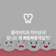 클리어 치과 상식 - 앞니 부분교정 전 꿀팁! 관련 이미지 12