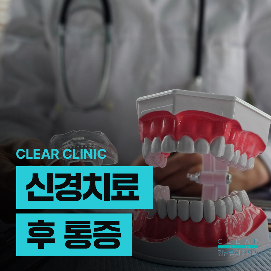 신경치료 후 통증이 생기는 이유 관련 이미지 1