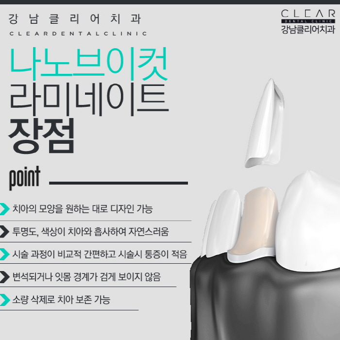 강남역라미네이트 잘하는곳 맞춤 제작 나노V컷 라미네이트 관련 이미지 8