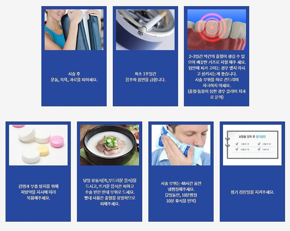 임플란트 실비 가능한지 찾는다면? 관련 이미지 8