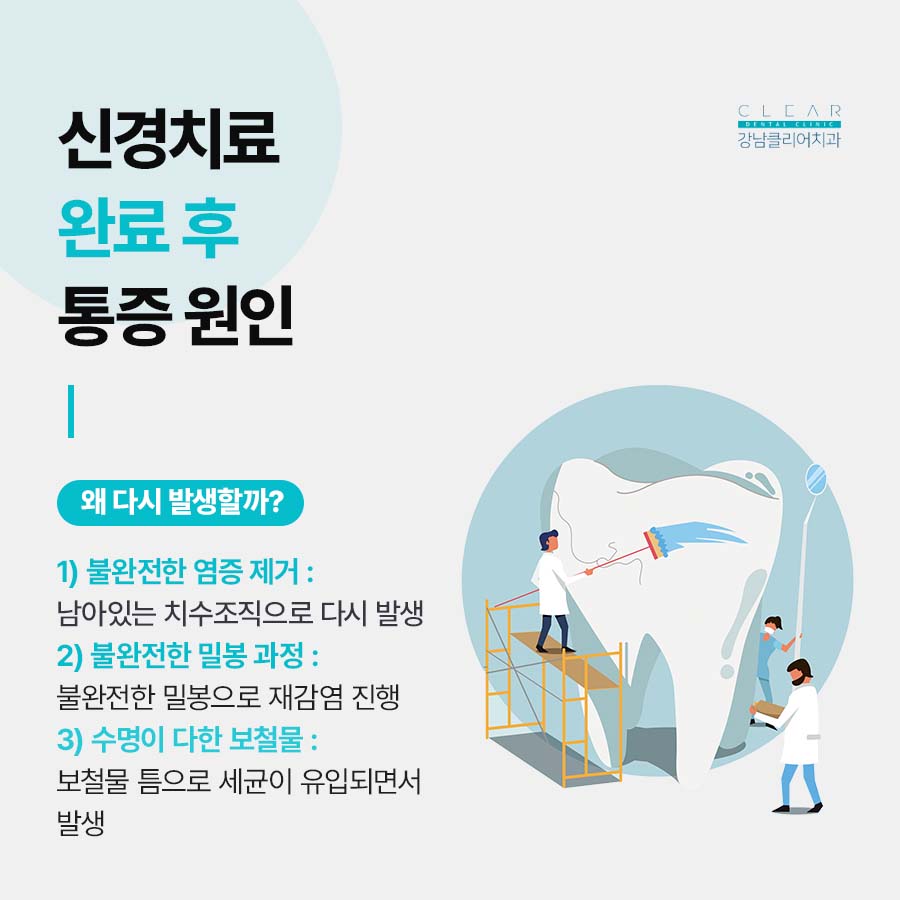 신경치료 완료 후 통증 원인 주의사항은? 관련 이미지 2
