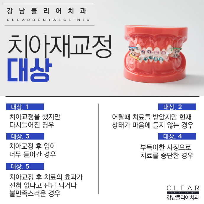 강남 치아재교정 치과 빠르고 확실하게 관련 이미지 3
