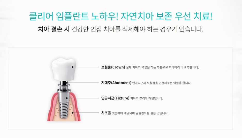 강남 임플란트치과 상황을 봐가면서 관련 이미지 2