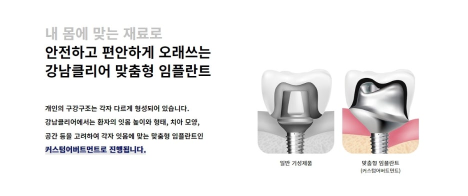 서울강남치과추천 정보를 면밀하게 수집하고 관련 이미지 7
