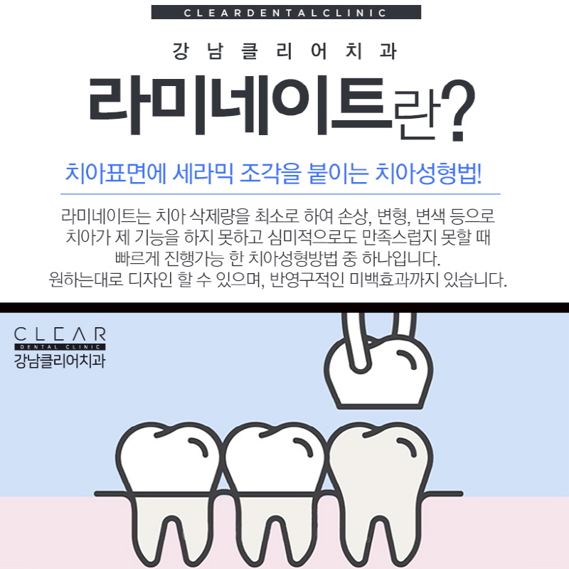 강남라미네이트 강도 고정력 유지기간 중요 관련 이미지 2