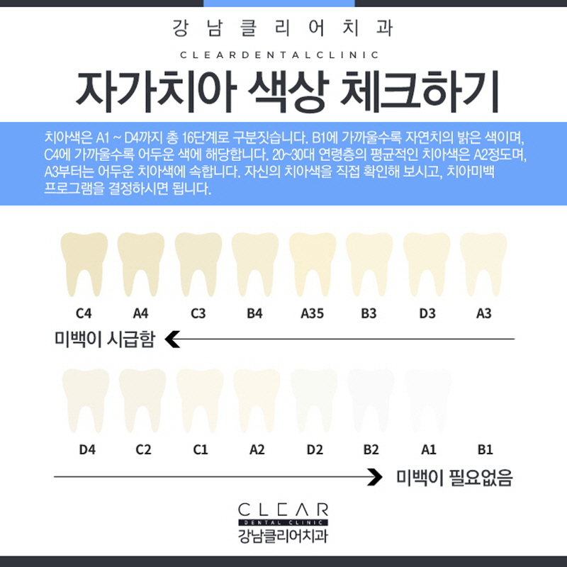 강남역치아미백 잘하는곳 고를때 중요한 요소 관련 이미지 2