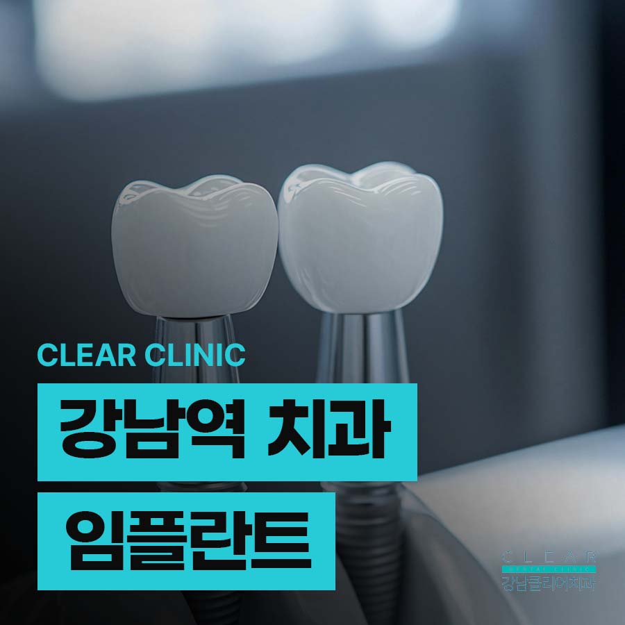강남역 치과 임플란트 구조와 치료기간 관련 이미지 1