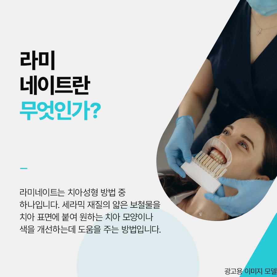 논현동 라미네이트 주의사항 꼭 알아야해요 관련 이미지 2