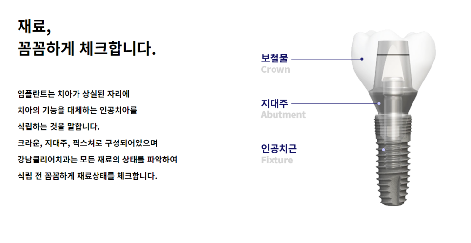 강남 임플란트 남다른 치과에서 관련 이미지 5