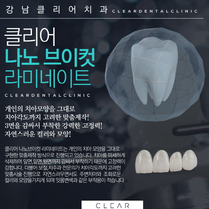 강남역라미네이트 잘하는곳 맞춤 제작 나노V컷 라미네이트 관련 이미지 4