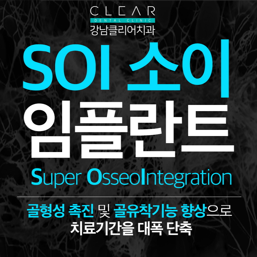 오스템임플란트 SOI임플란트 무엇이 다를까요? 관련 이미지 1