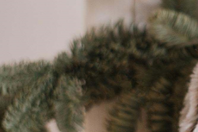 라미네이트 치아삭제 꼭 필요한 만큼만 해요 관련 이미지 27