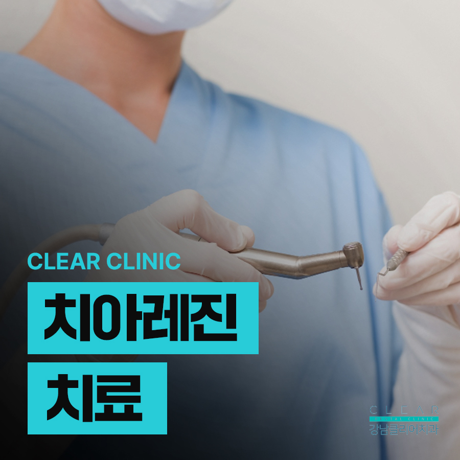치아레진치료 앞니 깨짐 개선방법으로 관련 이미지 1