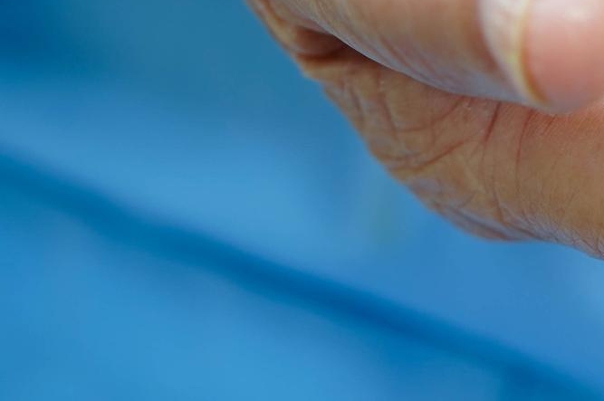 신경치료 후 통증이 생기는 이유 관련 이미지 30